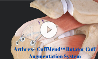 Arthrex - CuffMend™ Rotator Cuff Repair Augmentation System