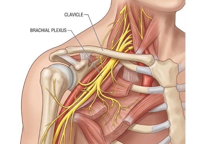 Brachial Plexus